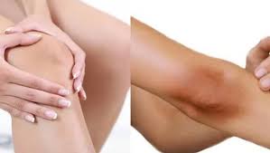 Khuỷu tay và đầu gối giúp trẻ hoá xương khớp với làn da