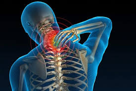 Thoái hóa đốt sống cổ và đau vai gáy